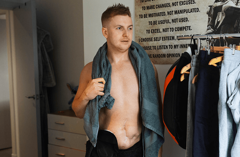 Mann mit Stoma wählt Kleidung aus